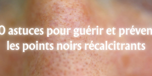 20 Astuces pour Prévenir et Guérir les Points Noirs Récalcitrants