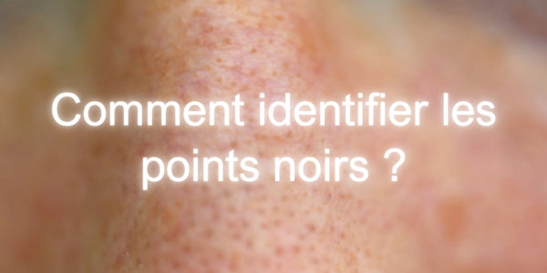 Comment identifier les points noirs ?