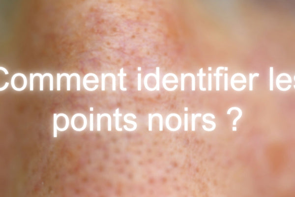 Comment identifier les points noirs ?
