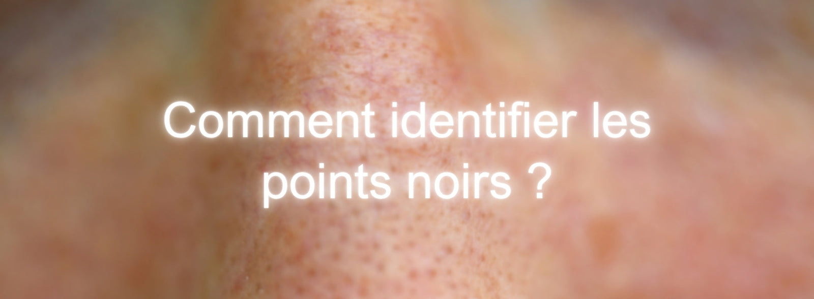 Comment identifier les points noirs ?