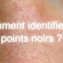 Comment identifier les points noirs ?