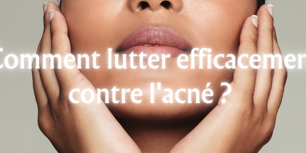 Comment lutter efficacement contre l'acné ?