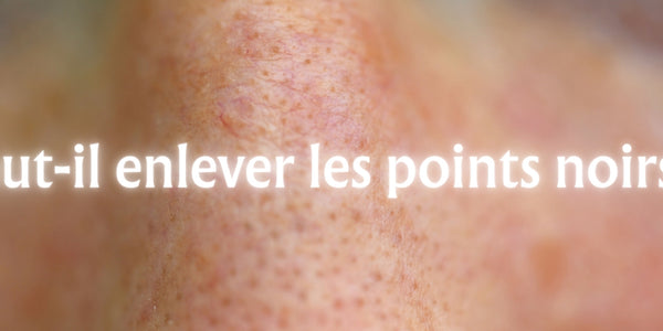 Faut-il enlever les points noirs ?