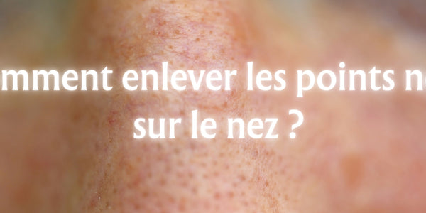 Comment enlever les points noirs sur le nez ?