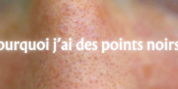 Pourquoi j'ai des points noirs ?