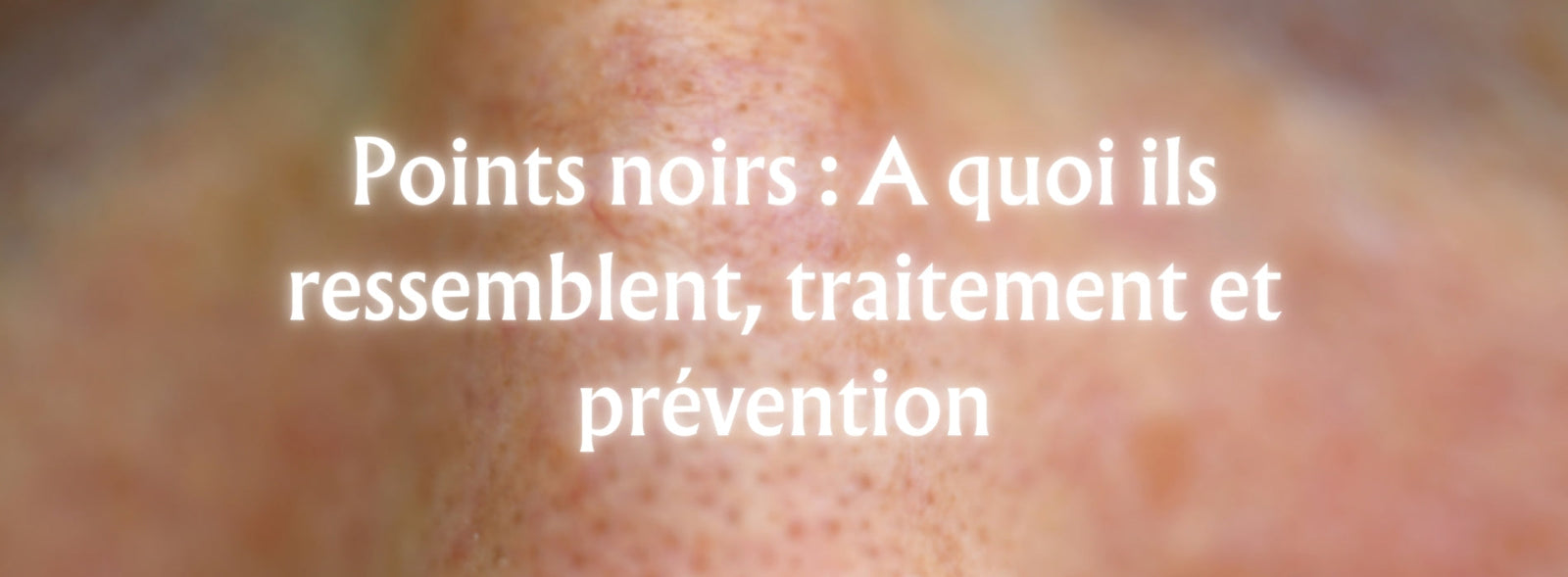 Points noirs : A quoi ils ressemblent, traitement et prévention
