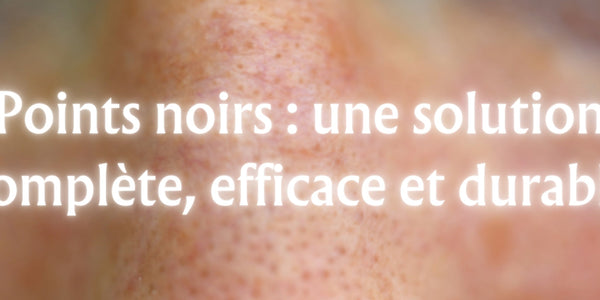 Points noirs : une solution complète, efficace et durable