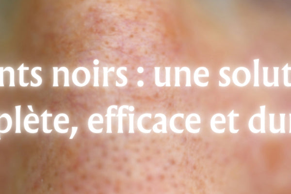 Points noirs : une solution complète, efficace et durable