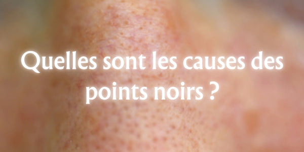 Quelles sont les causes des points noirs ?