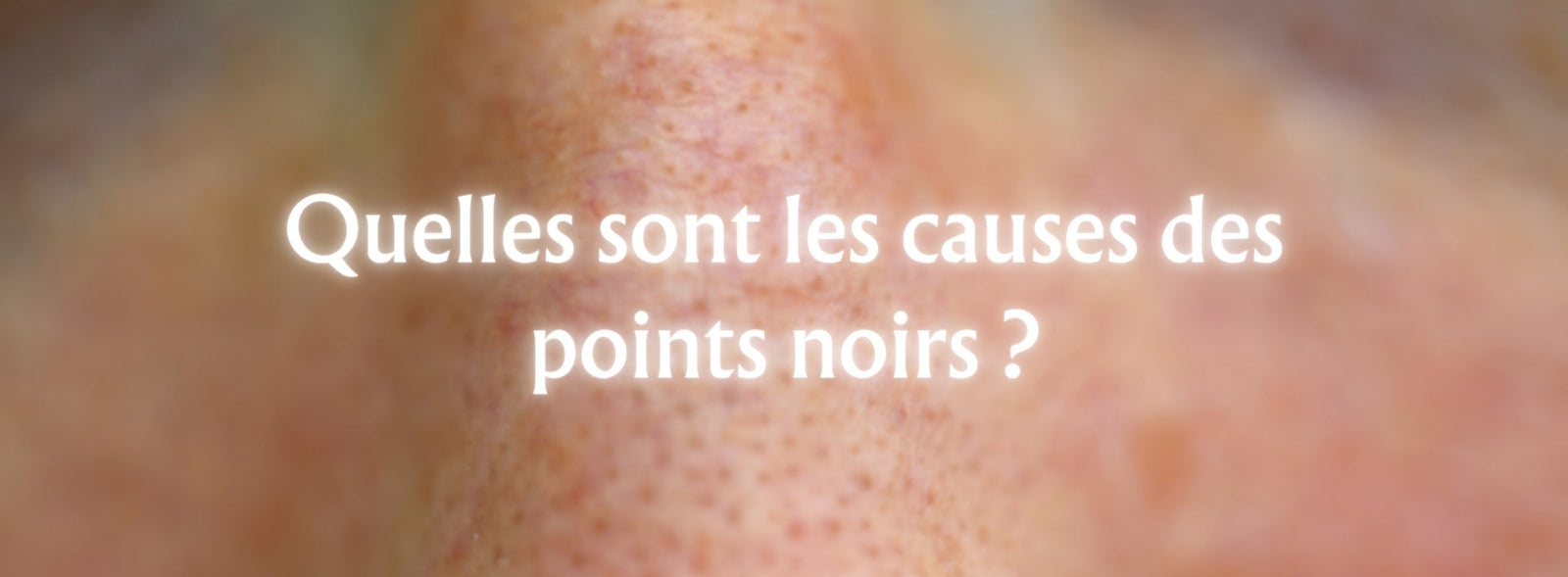 Quelles sont les causes des points noirs ?