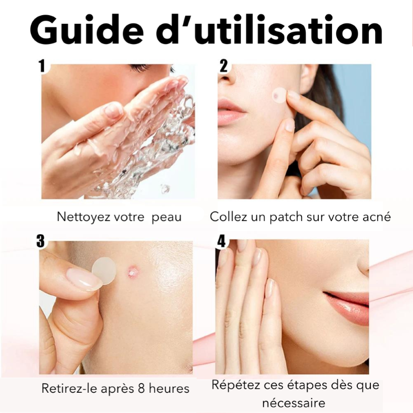 Patch anti-acné