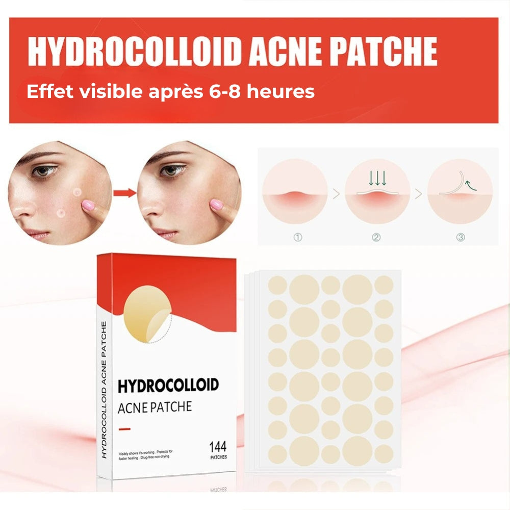 Patch anti-acné