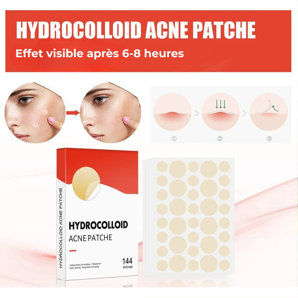 Patch anti-acné
